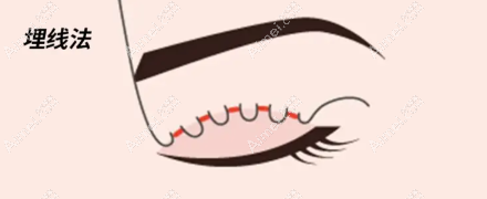 南通爱时光沈正洲医生怎么样? 南通爱时光沈正洲医生怎么样?