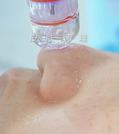 上海李敏面部提升医生个人简介?80后医生操作细节曝光,胶原灌注是优势,1.2-1.5万起