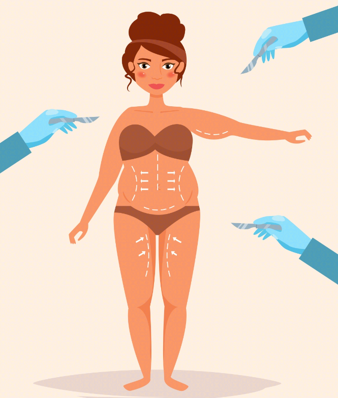 冯斌手臂抽脂14万不贵