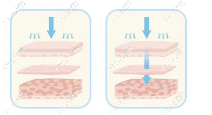 水光导入 水光导入