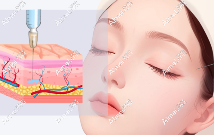 轮廓固定 轮廓固定