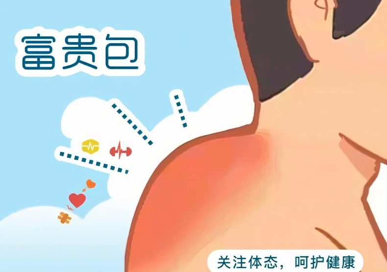 黄学锋消除富贵包是真的吗!电动螺旋刀碎深层纤维,30分钟微创吸除,颈后线条流畅,Ⅰ型1.98万起