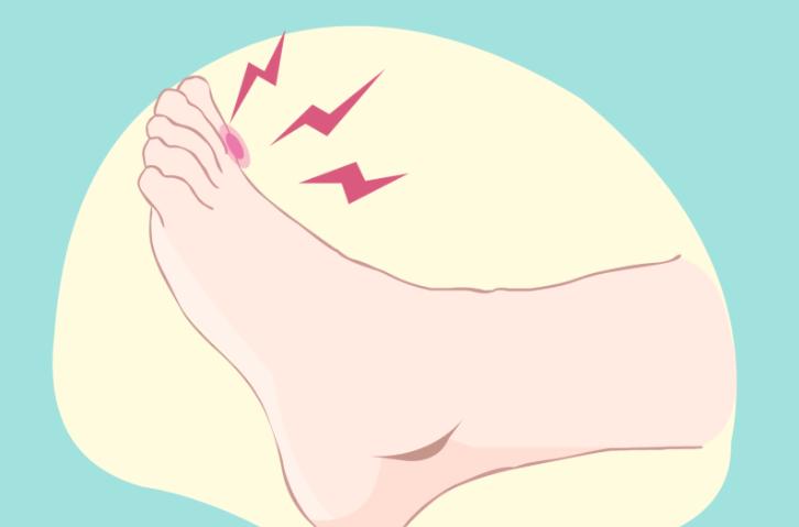 拇外翻手术3d模拟效果咋样?亲测2025新版模拟超还原手术步骤