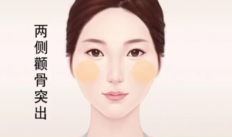 上海颧骨内推项目分析