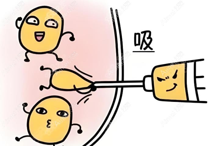 北京八大处吸脂示意图