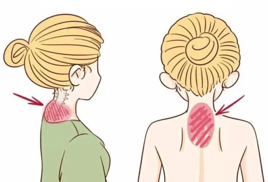 李德明治疗富贵包