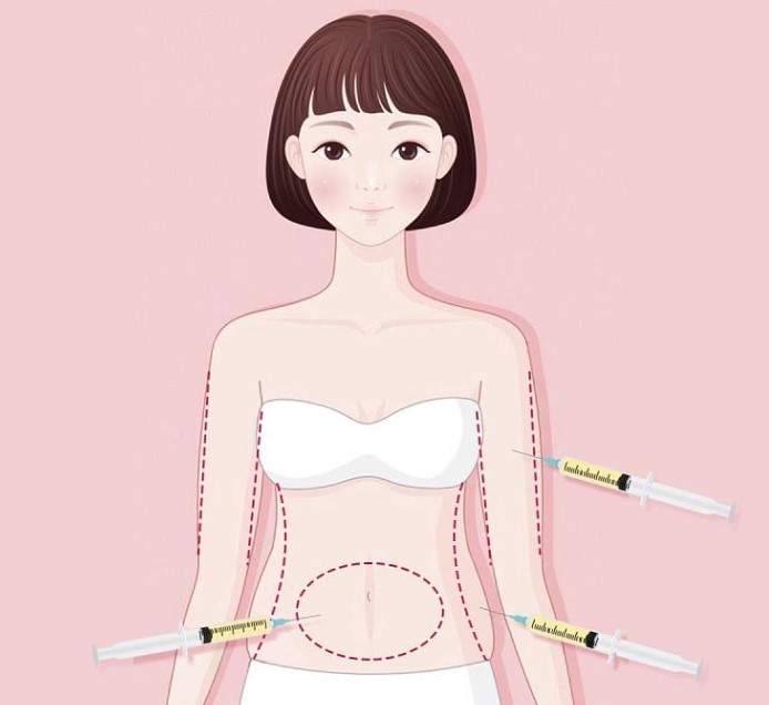 北京艺美医疗美容诊所做吸脂的优势