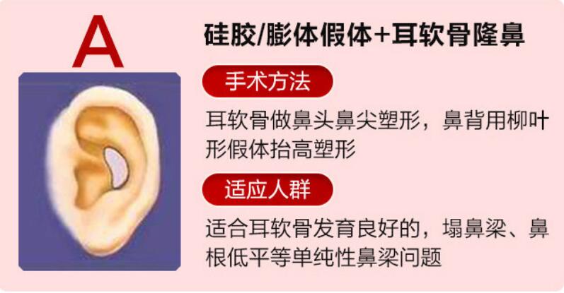 深圳非凡整形梅够明医生做鼻子口碑真实吗？多位求美者术后分享，风格自然而且不会过度