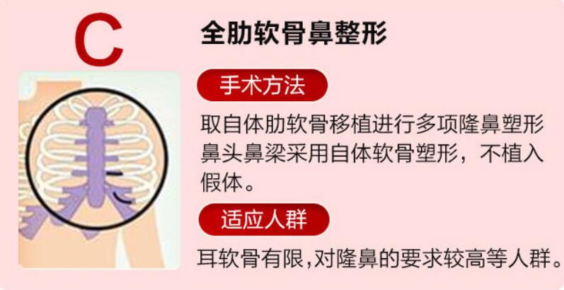 三、技术风格拆解:深圳非凡整形梅够明医生做鼻子口碑为啥被叫“细节狂魔”?