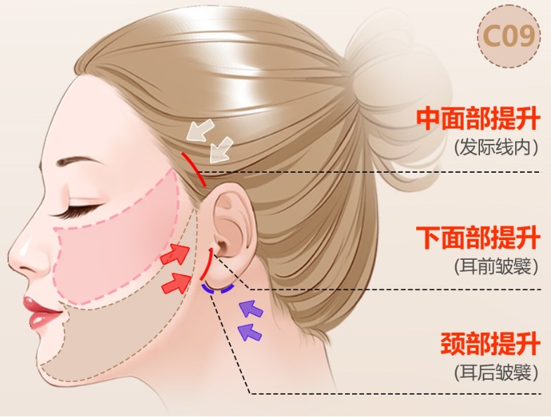 孙玮骏的速拉美要15万吗