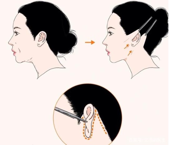 孙玮骏速拉美价格构成