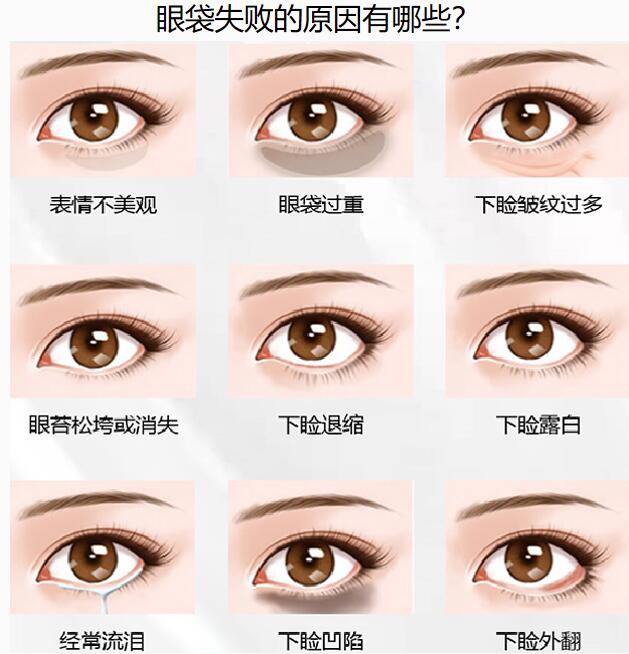 北京印正山是眼综合修复靠谱机构