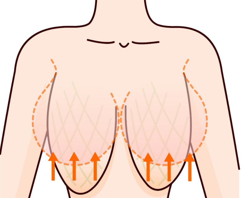 深圳南雅刘富增医生个人简介全解析！是做筋膜+花苞提胸+腹壁成型的多项目医生