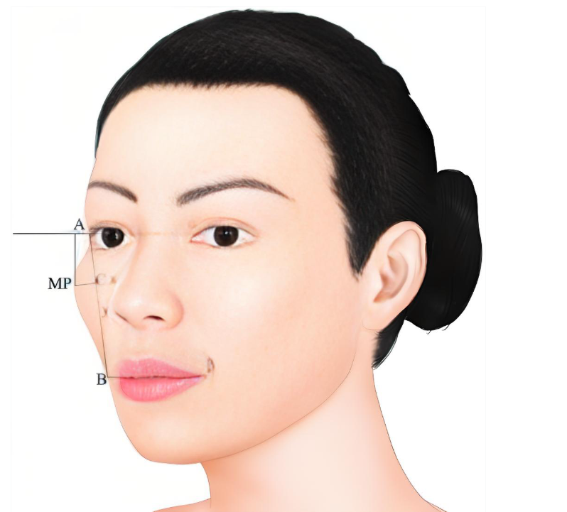 上海鼻子李翔医生的医院地址