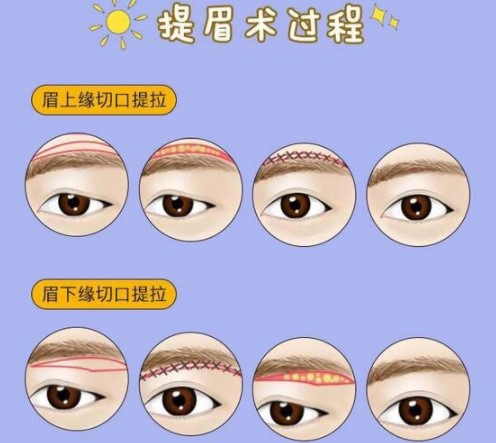 朱唯灵医生的技术特色与项目解析