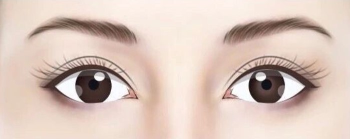 马传勋医生内眼角修复技术特色解析