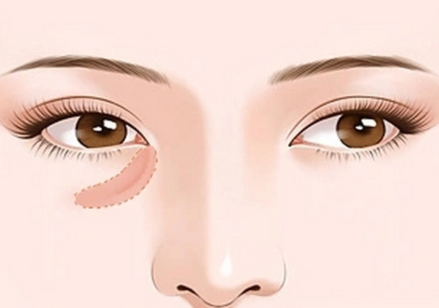 预约马传勋医生双眼皮手术的实用指南