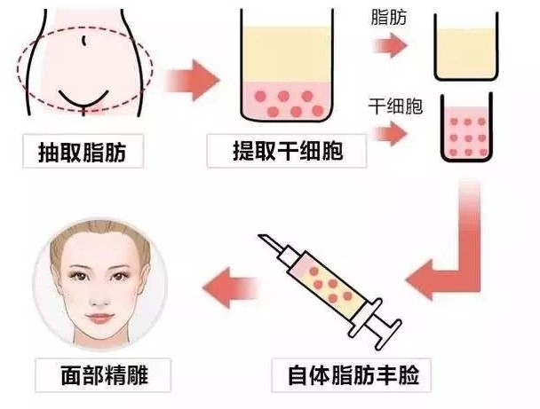 上海伯思立就诊全攻略