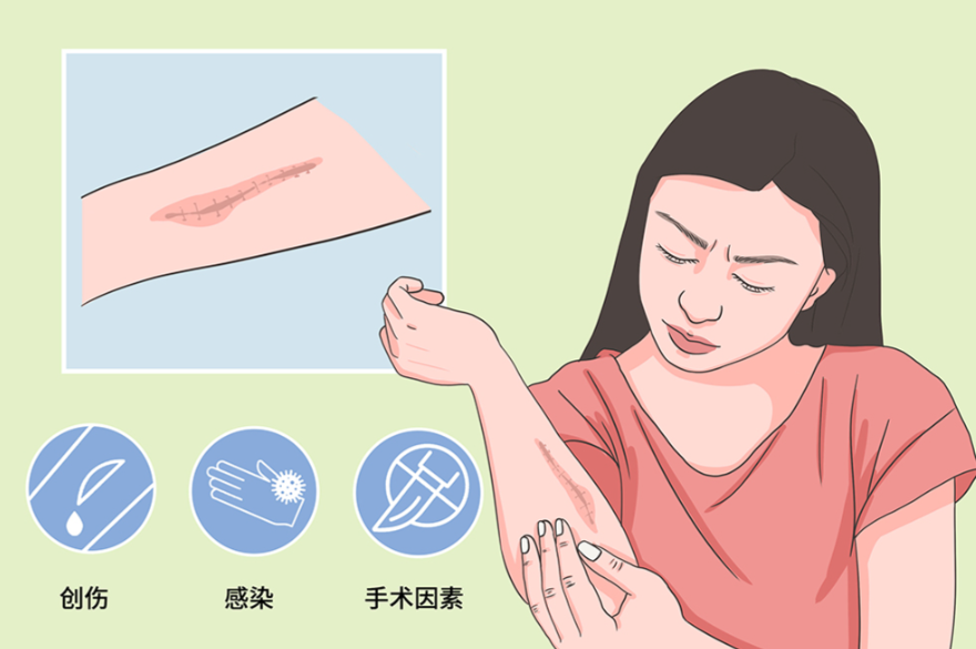 盐城东方女子医院疤痕修复