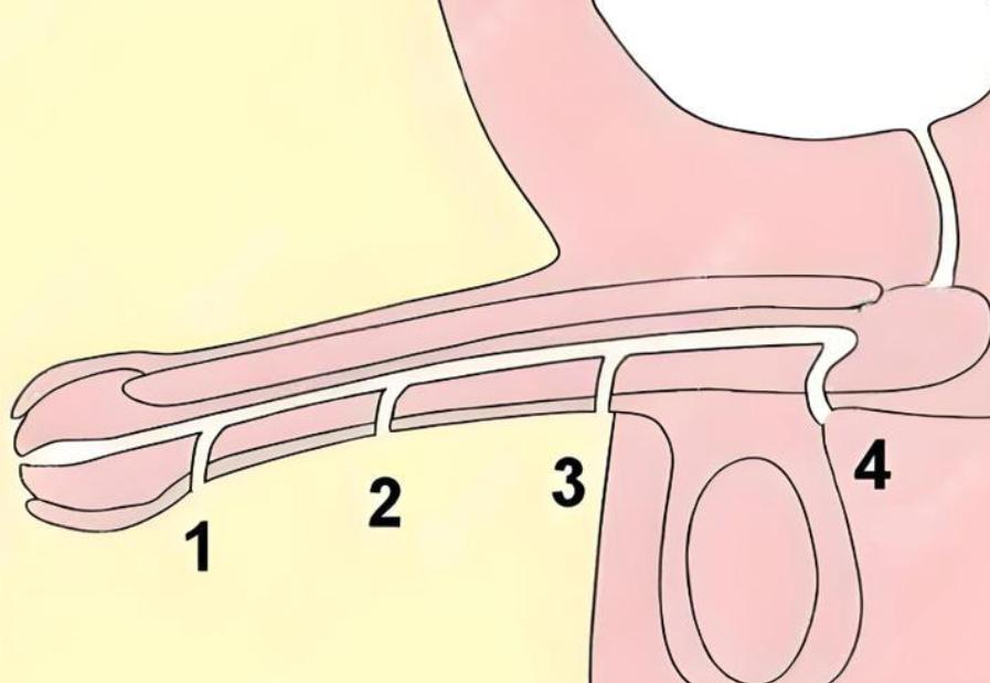 男科真皮补片增粗