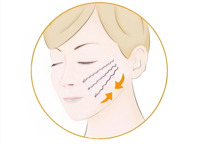 北京黄寺中下面部提升价格多少钱