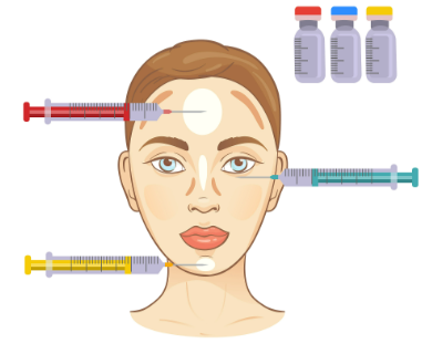 蒋丽芳医生注射卧蚕幼态脸价格3万起