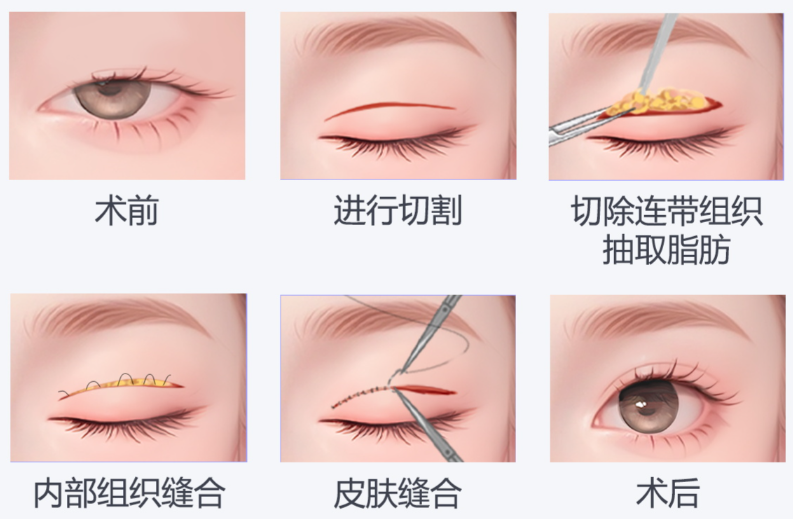上海爱尚丽格眼修复技术