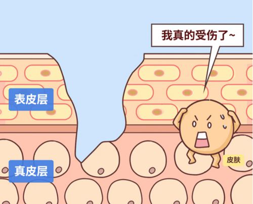 国内能做瘢痕SRT - 100的正规医院名单