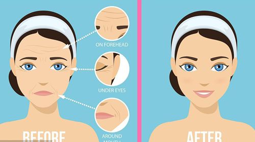 大拉皮手术前后对比