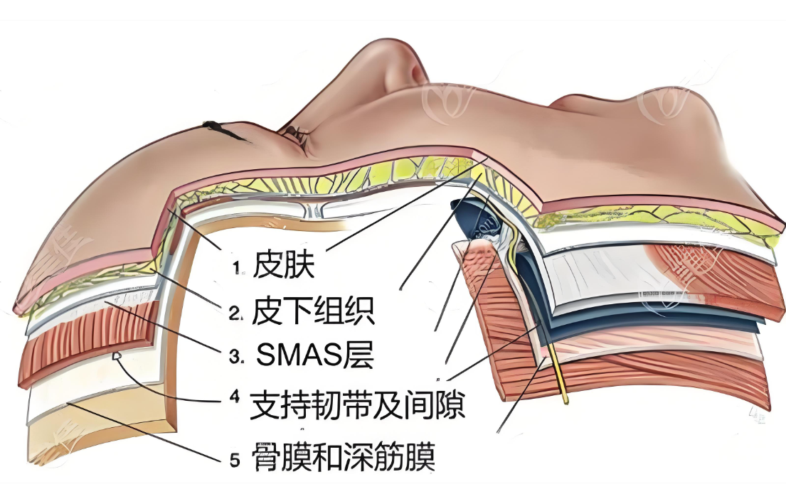 上海倪锋拉皮医生怎么预约挂号？2025年伯思立坐诊，显微拉皮2w+，附挂号全攻略