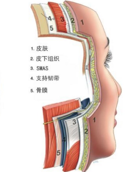 隋冰医生拉皮多少钱