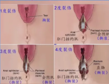 今年全新广州私密修复医院排名:省妇幼/曙光/紫馨等5家正规机构实力解析