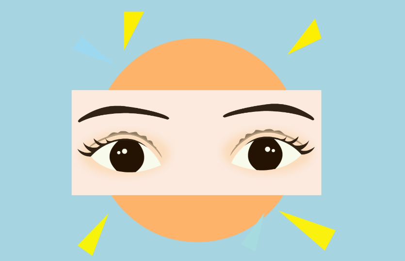 卢玲双眼皮提肌修复实例分享:修复后眼型超自然不瞪眼,附3个前后效果对比图