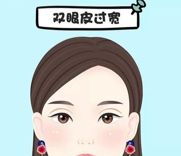 吴焱秋双眼皮当下实例:2025年3个月变好过程全解析