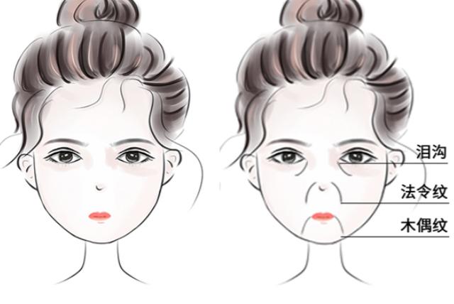 何锦泉正颌手术的技术