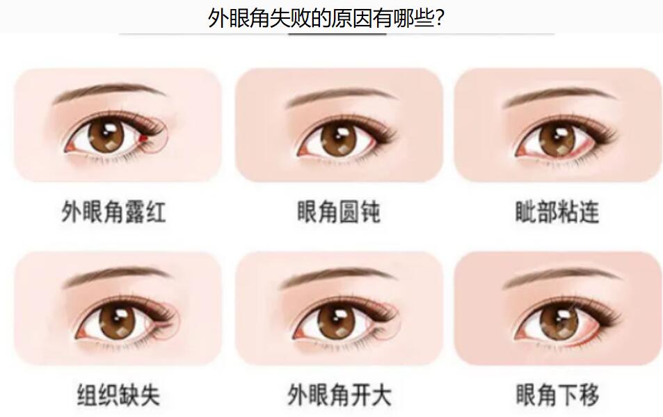 北京吴焱秋魏志香师丽丽谁更好