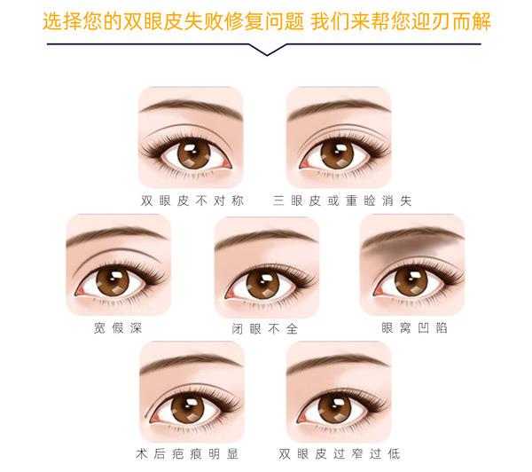 师丽丽适合做妈生眼