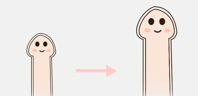 选择刘蒙医生做男性私密整形，这些问题要提前沟通