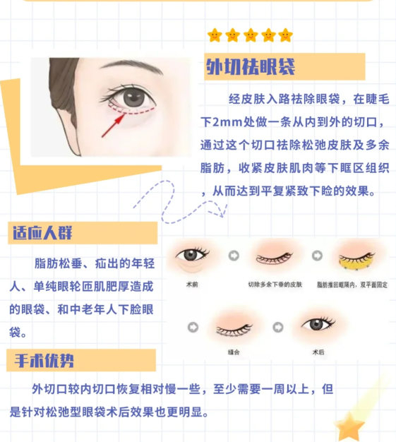 深圳鹏程整形医院祛眼袋