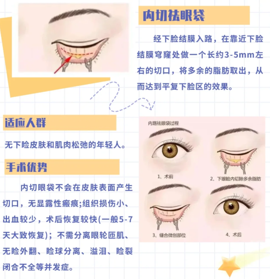 深圳鹏程整形医院祛眼袋价格