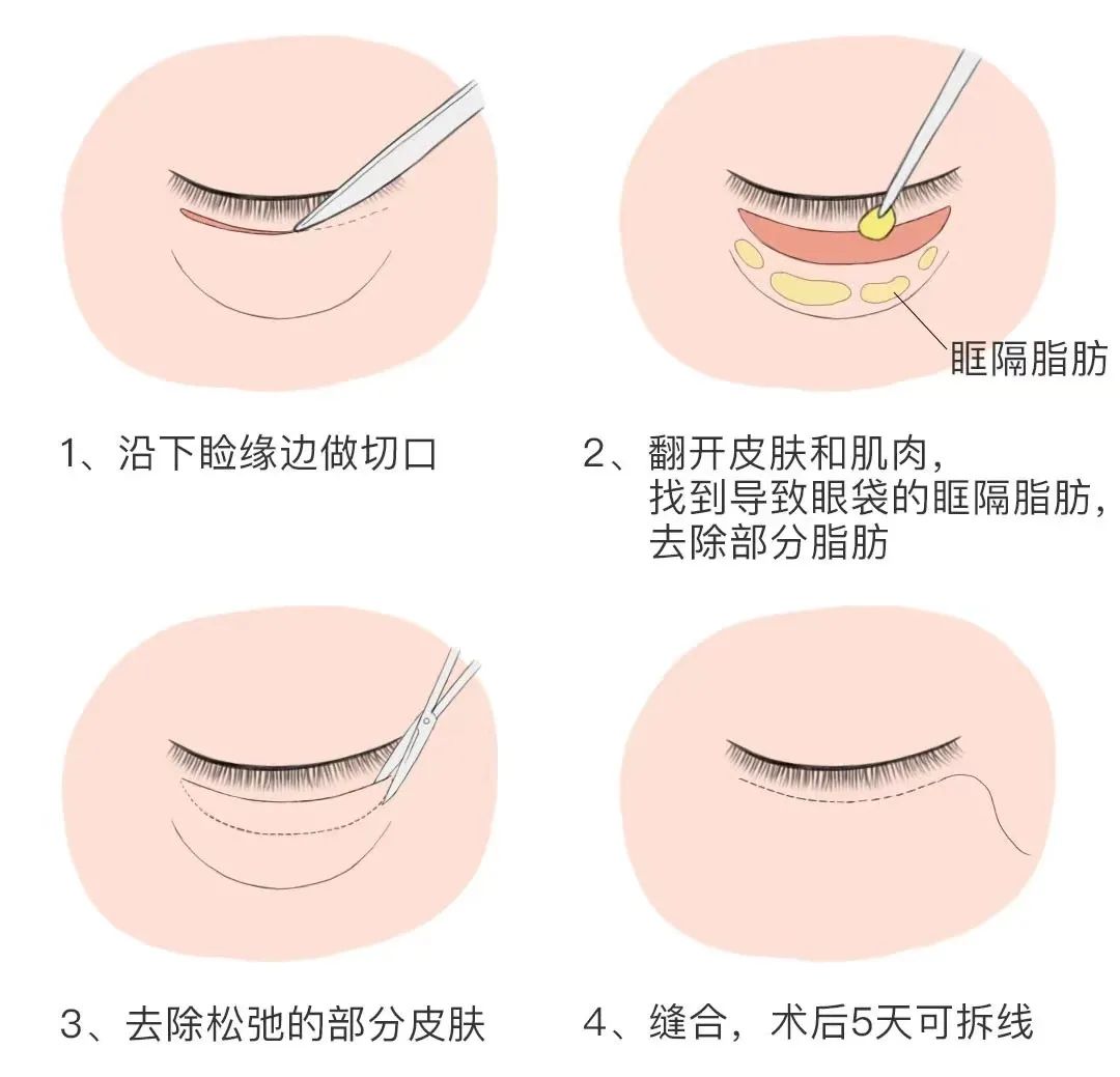 选择爱思特麻慧菱医生的就诊建议