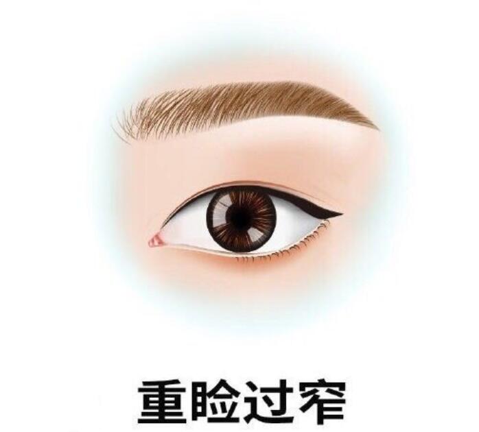 长沙爱思特麻慧菱收费贵吗？双眼皮手术价格公开，术后效果自然不夸张