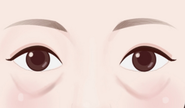 锦州医疗美容医院王汇东做眼整形技术靠谱吗?对比传统手术,它的个性化设计更独特