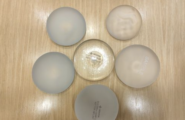 鲁天宇假体隆胸的真实实例与求美者口碑反馈