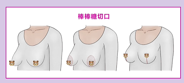 魔滴1050cc假体的核心参数