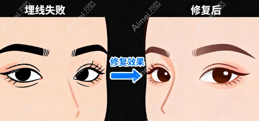 找杨晨光博士修复:避坑建议 + 注意事项 找杨晨光博士修复:避坑建议 + 注意事项