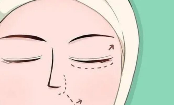 深圳非凡整形医院做双眼皮的优势