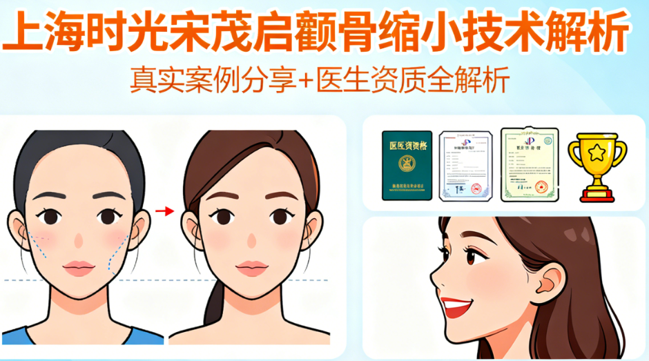 上海时光宋茂启颧骨缩小技术靠谱吗？真实案例分享+医生资质全解析，看完再决定