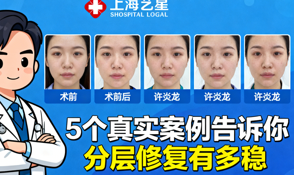 上海艺星许炎龙用户真实评价与常见问题解答