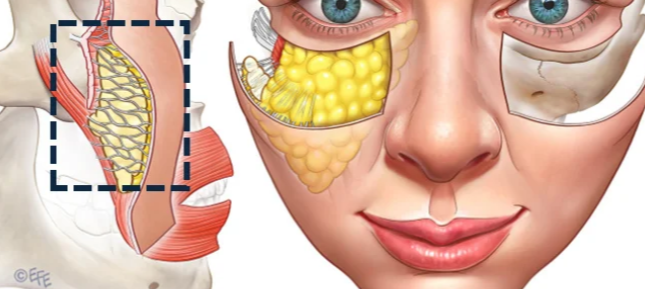 杭州苹果肌复位哪个整容医院比较好，不割韭菜推荐，这8家技术稳术后满意度高